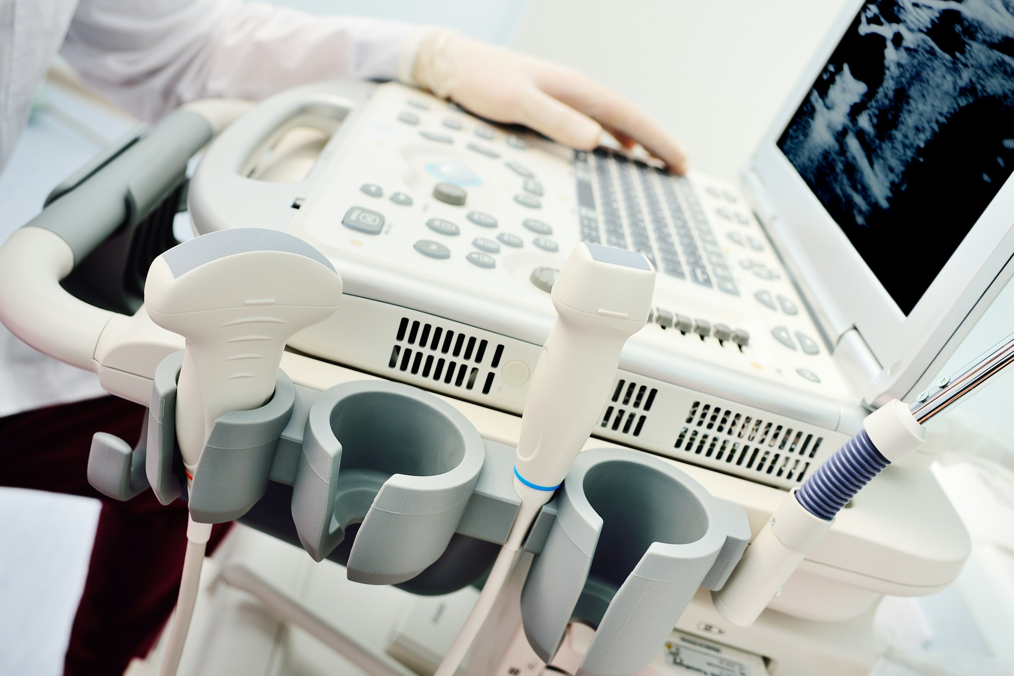 doctor's hands in medical gloves close-up against the background of a modern ultrasound machine