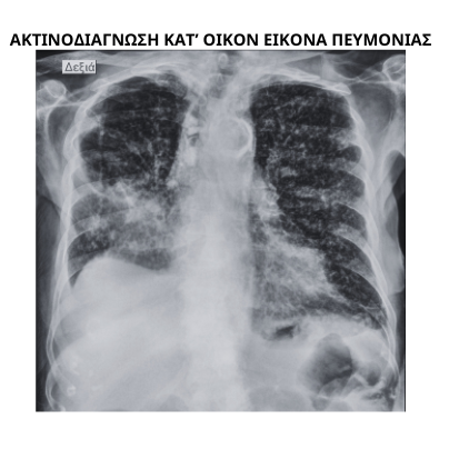 Η γρίπη και οι ηλικιωμένοι 5